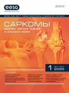 Саркомы костей, мягких тканей и опухоли кожи
